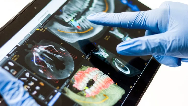 zahnarzt visp dr med juergen burgener 02 768x432